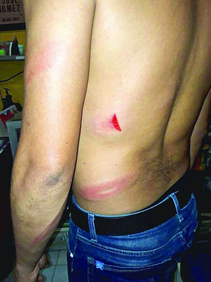 Taxista Huixtleco Atacó con un Bate a Pasajero