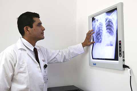 En Chiapas se Garantiza el Diagnóstico y Tratamiento Contra la Tuberculosis